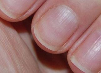 Причины и лечение бугристых ногтей на руках